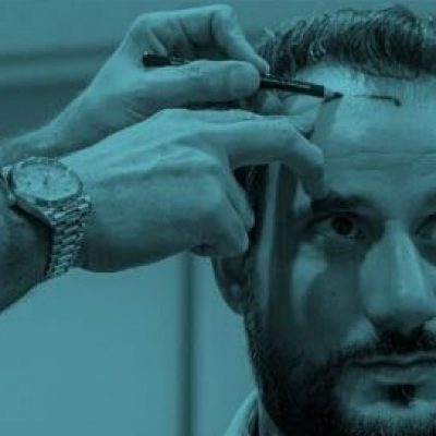 Sac_ekimi_oncesi-min